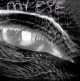 My eye, everyone says it’s a shadow, I don’t think so !!!!